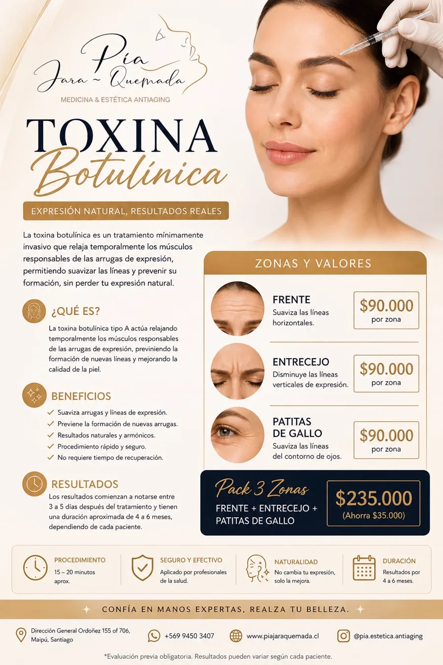Valores de toxina botul&iacute;nica en Maip&uacute;: frente, entrecejo y patitas de gallo a $90.000 por zona y pack de 3 zonas a $235.000