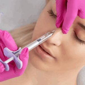 Rinomodelación con Ácido Hialurónico