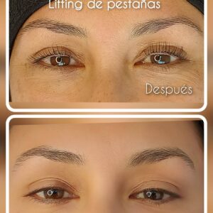 Lash Lifting con Bótox (Elevación y tinte de pestañas, semi-permanente)