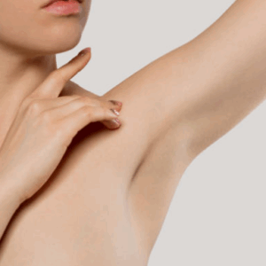 Depilación Tri-Láser Pack Rebaje total + axilas + bozo (Femenino)