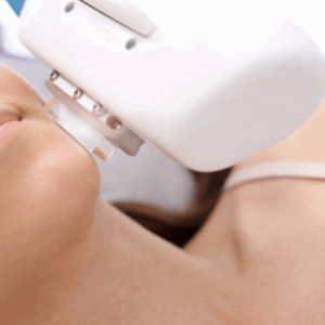 Depilación Tri-Láser Rostro inferior