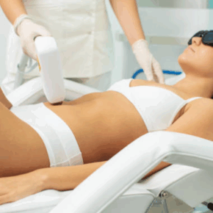 Depilación Tri- Láser Abdomen bajo (Femenino)