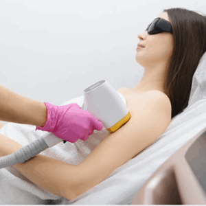 Depilación Tri-Láser Pack Brazo completo + hombros (Femenino)