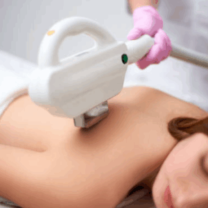 Depilación Tri-Láser Espalda completa (Femenino)