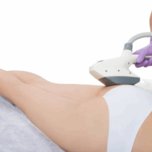 Depilación Tri-Láser Pack Rebaje total + glúteos + interglúteos (Femenino)