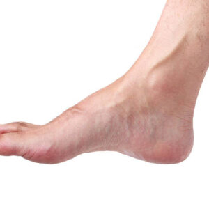 Depilación Tri-Láser pies (Masculino)