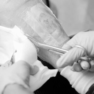 Enfermera realizando una curación avanzada en el brazo de un paciente, utilizando técnica estéril y materiales especializados.