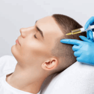 Profesional aplicando mesoterapia capilar en el cuero cabelludo de una paciente para estimular el crecimiento del cabello.